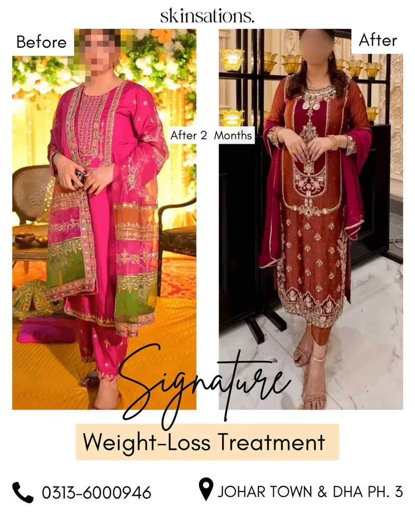 Signature 2-Month Medical Weight Loss — Before and After at Skinsations Lahore